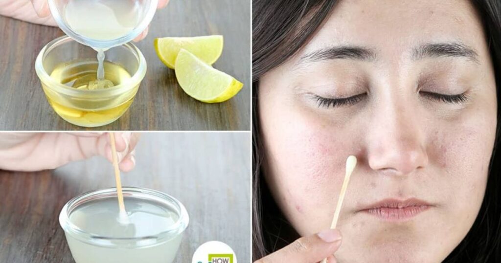 How Lemon Juice Works to Remove Dark Spots